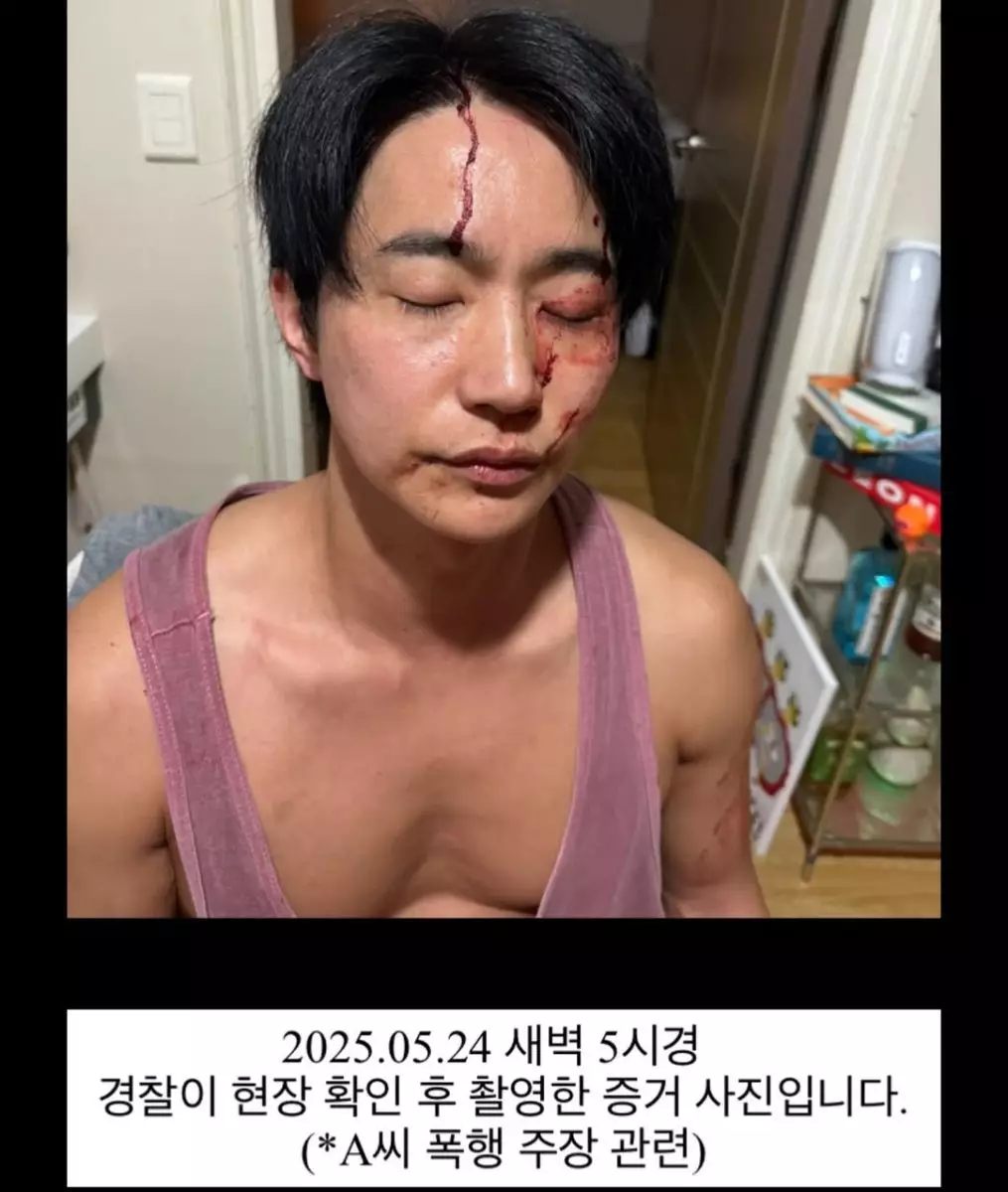 全浩俊在5月25日發文反駁,更指自己被前女友毆打。 全浩俊IG圖片