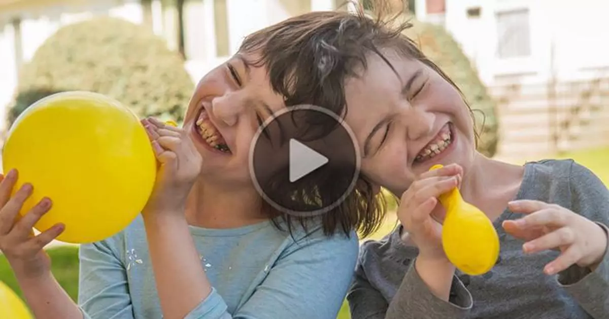 Conjoined twins celebrates 11th birthday in October