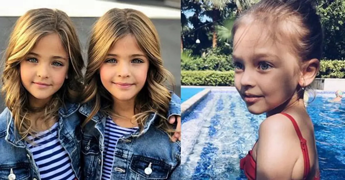 Twins win lots of fans and contracts with stunning photos