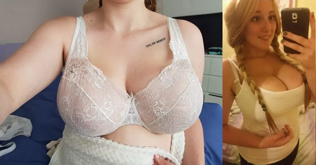 Mum with 36K breasts needs to raise £6k for breast reduction after being turned down for NHS op