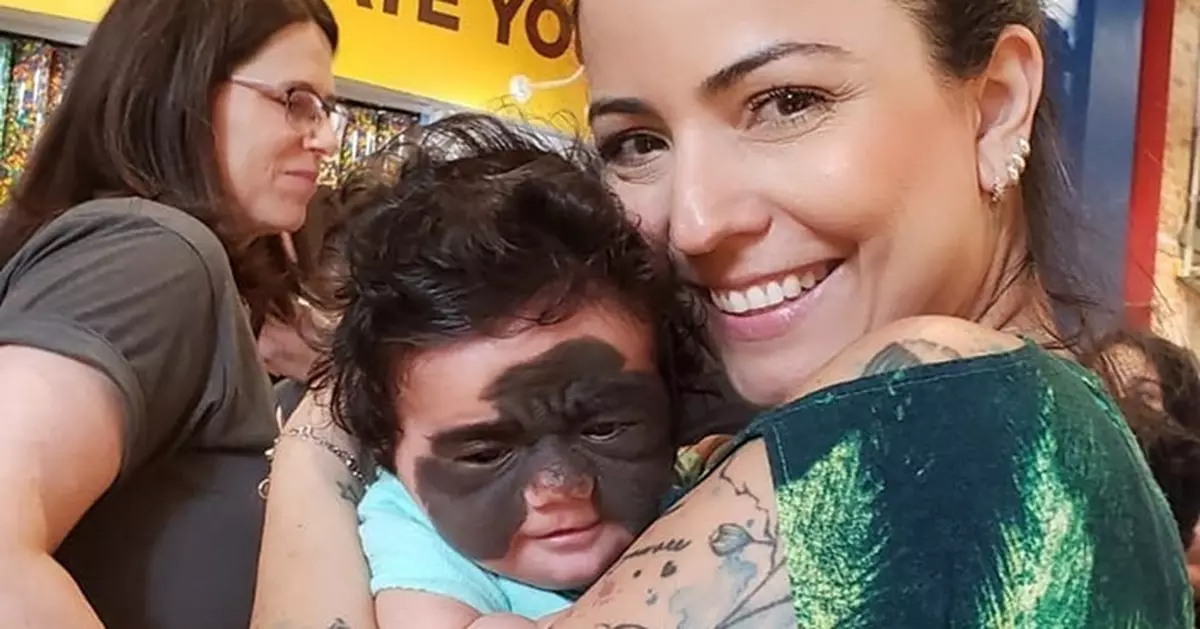Video: Mum of baby with unique black ‘batman’ birthmark hits back at those calling the tot ‘monster’ 