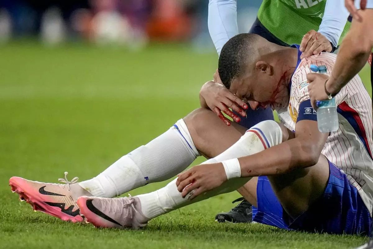 Kylian Mbappe of France receives a treatment after suffering an injury during a Group D match between Austria and France at the Euro 2024 soccer tournament in Duesseldorf, Germany, Monday, June 17, 2024. (AP Photo/Alessandra Tarantino)