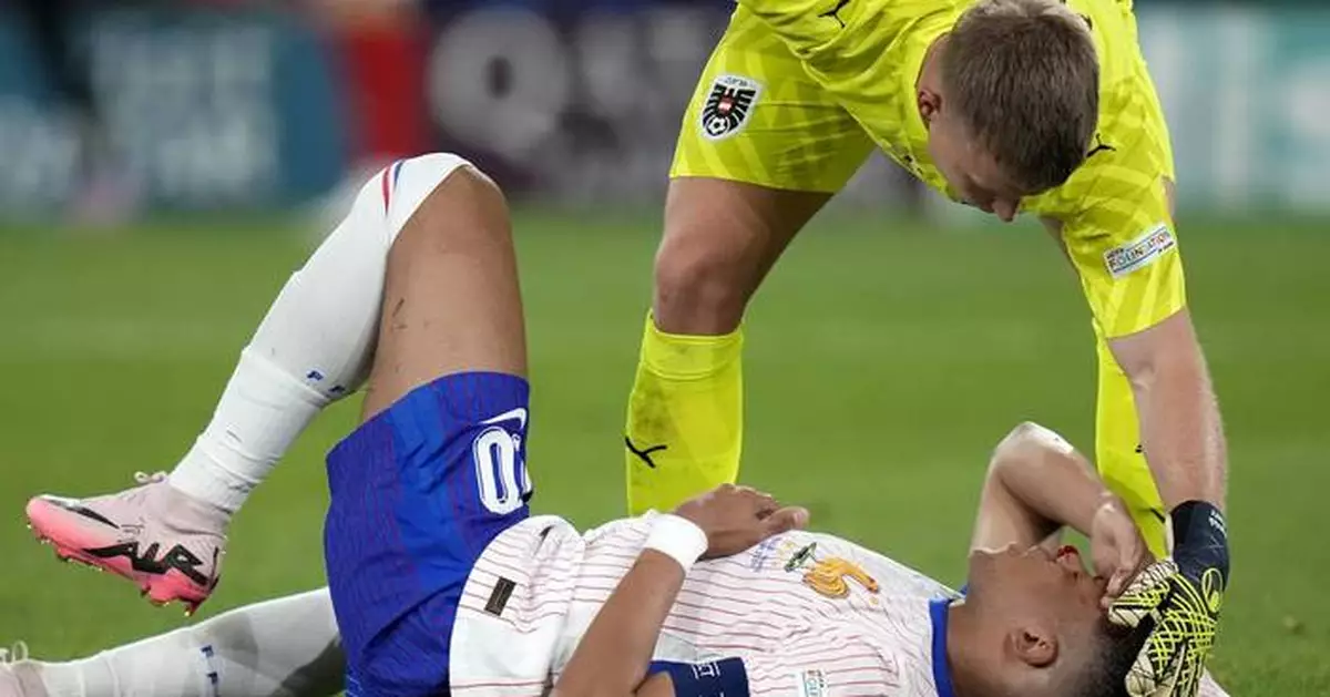 Kylian Mbappé due for tests on his broken nose as France gets 'positive' news on the striker