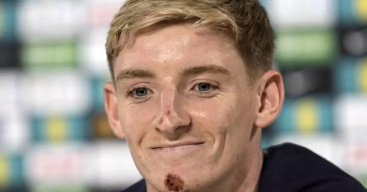 England winger Gordon escapes serious injury from bike accident during downtime at Euro 2024
