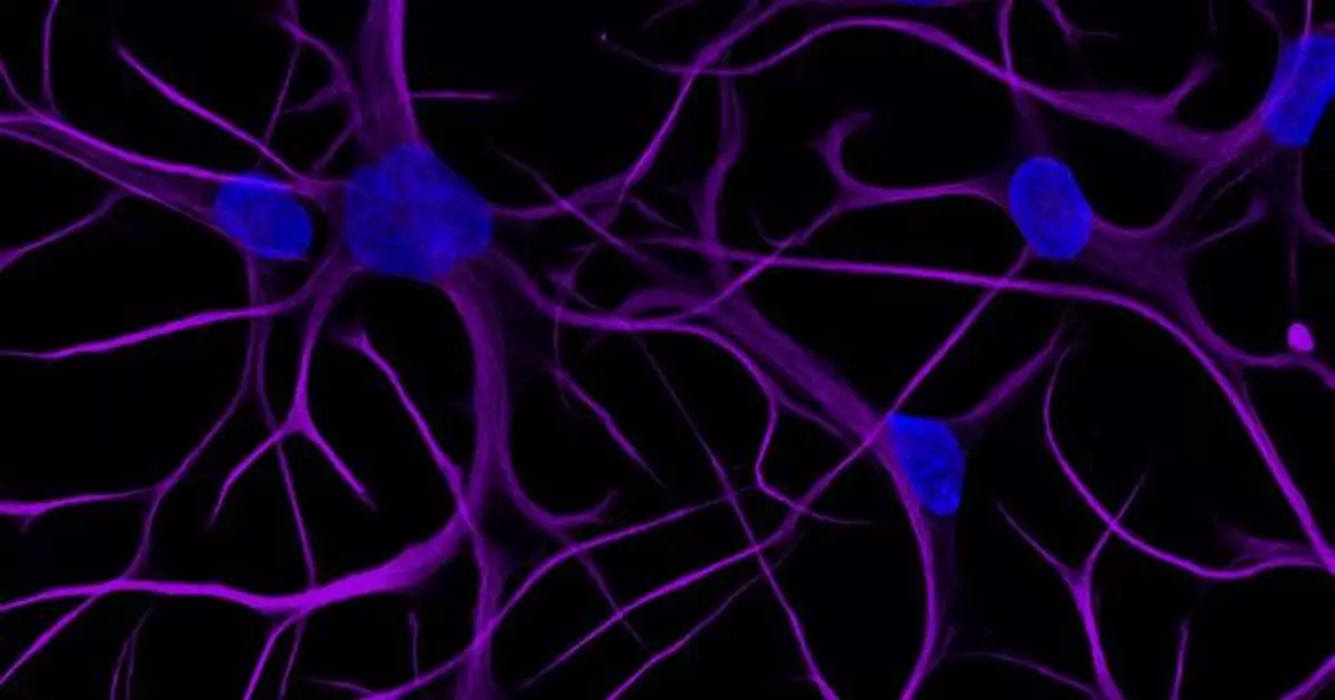 bit.bio Launches ioAstrocytes, Advancing How Scientists Can Model the Human Brain