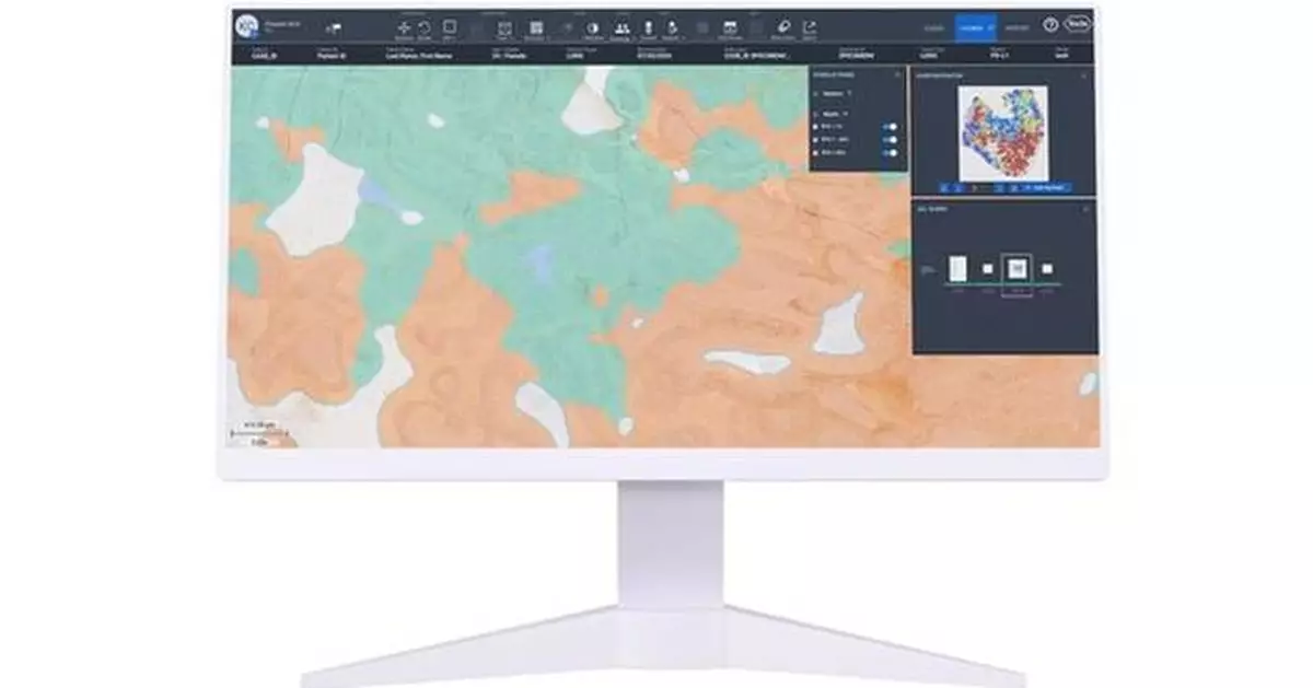 Lunit Joins Roche's Digital Pathology Open Environment to Advance Cancer Biomarker Testing