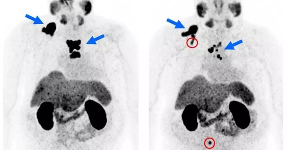 Copper-67 SAR-bisPSMA updates