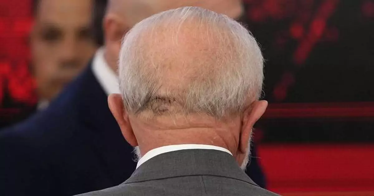 Doctors say Brazil's Lula is recovering after surgery for a brain bleed