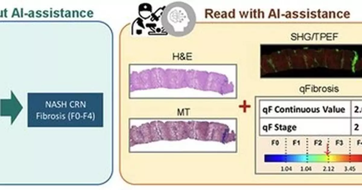 BRIDGING CLINICAL RESEARCH AND CLINICAL CARE WITH AI-AIDING PATHOLOGISTS TOOL