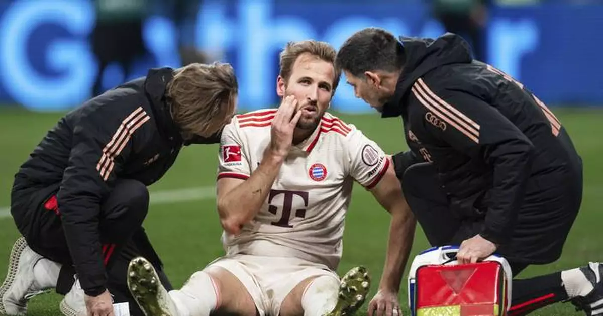 Harry Kane misses Bayern training with facial injury a day ahead of Celtic game