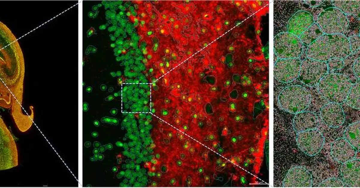 Bruker Spatial Biology to Announce Groundbreaking Advances at AGBT 2025