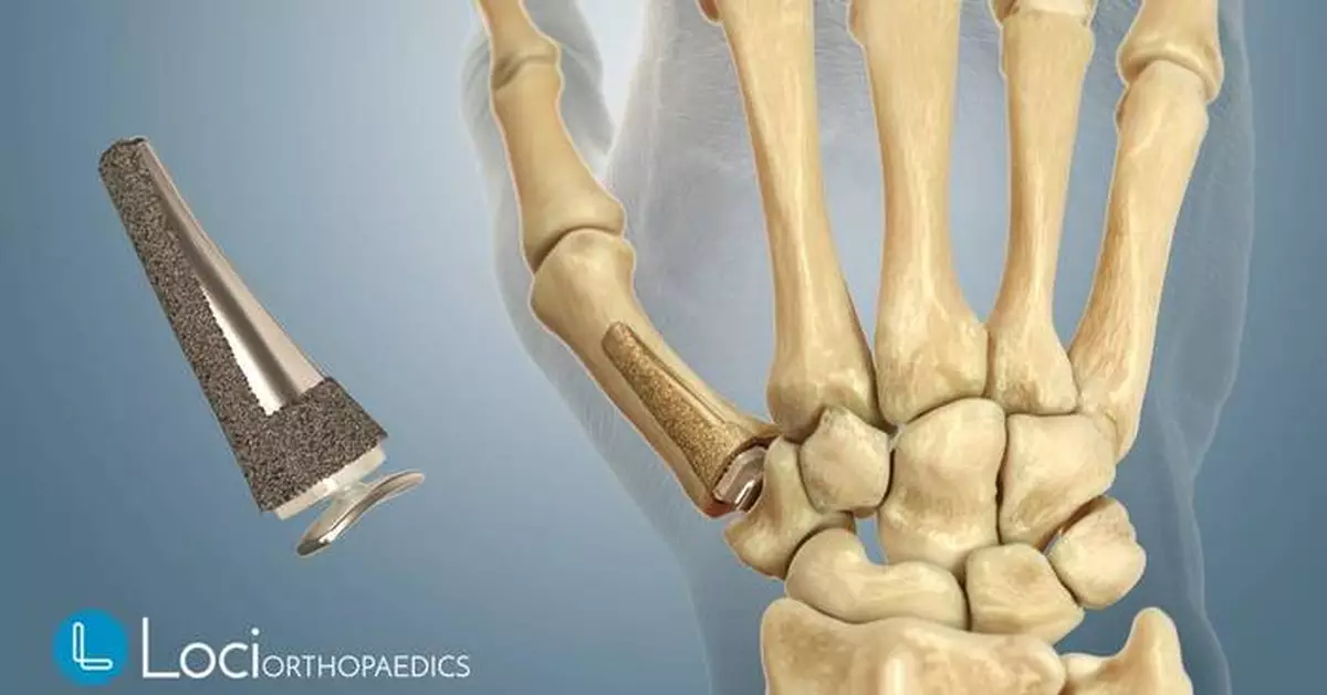 Attendance at the 2025 IFSSH and IFSHT Triennial Global Hand Care Congress