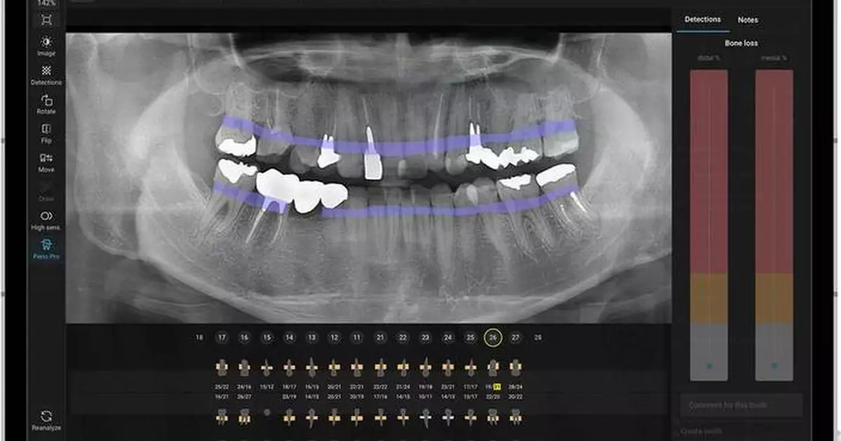 Align Technology Launches Align X-ray Insights, an AI Computer-Aided Detection Software, in the European Union and United Kingdom