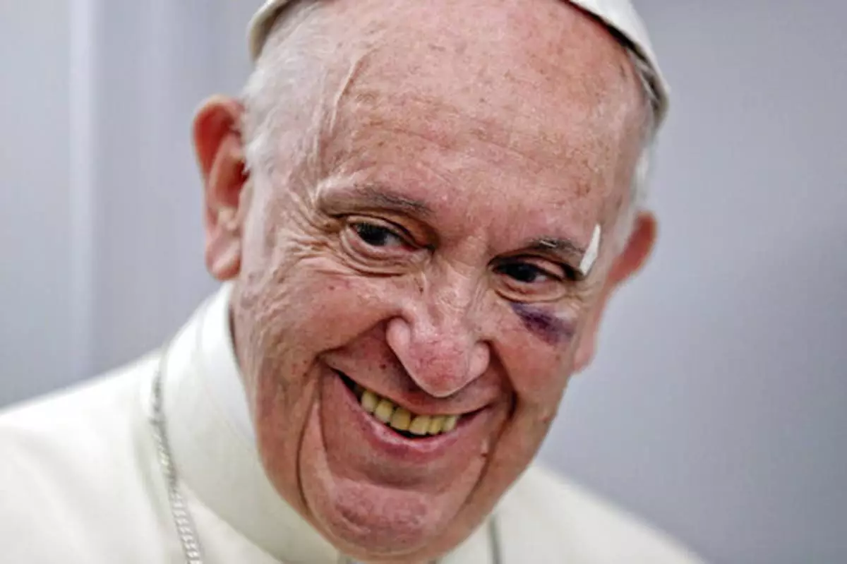 FILE - Pope Francis wears a plaster and has a bruised, black left eye and a cut on his eyebrow as he talks to journalists during a press conference on board the flight to Rome, at the end of a five-day visit to Colombia, where he banged his head on his popemobile when it stopped short amid swarms of well-wishers and he lost his balance, having only had a hip-high bar to hold onto, Monday, Sept. 11, 2017. (AP Photo/Andrew Medichini, pool, file)