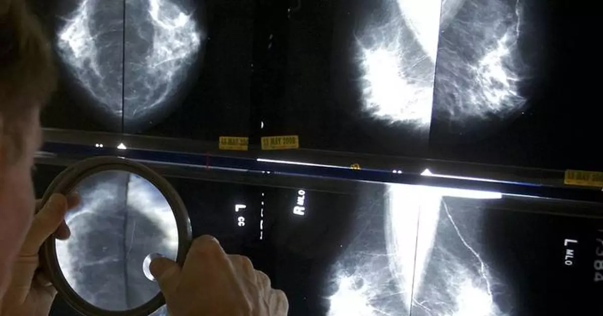 Advanced cancers returned to prepandemic levels, according to a reassuring report