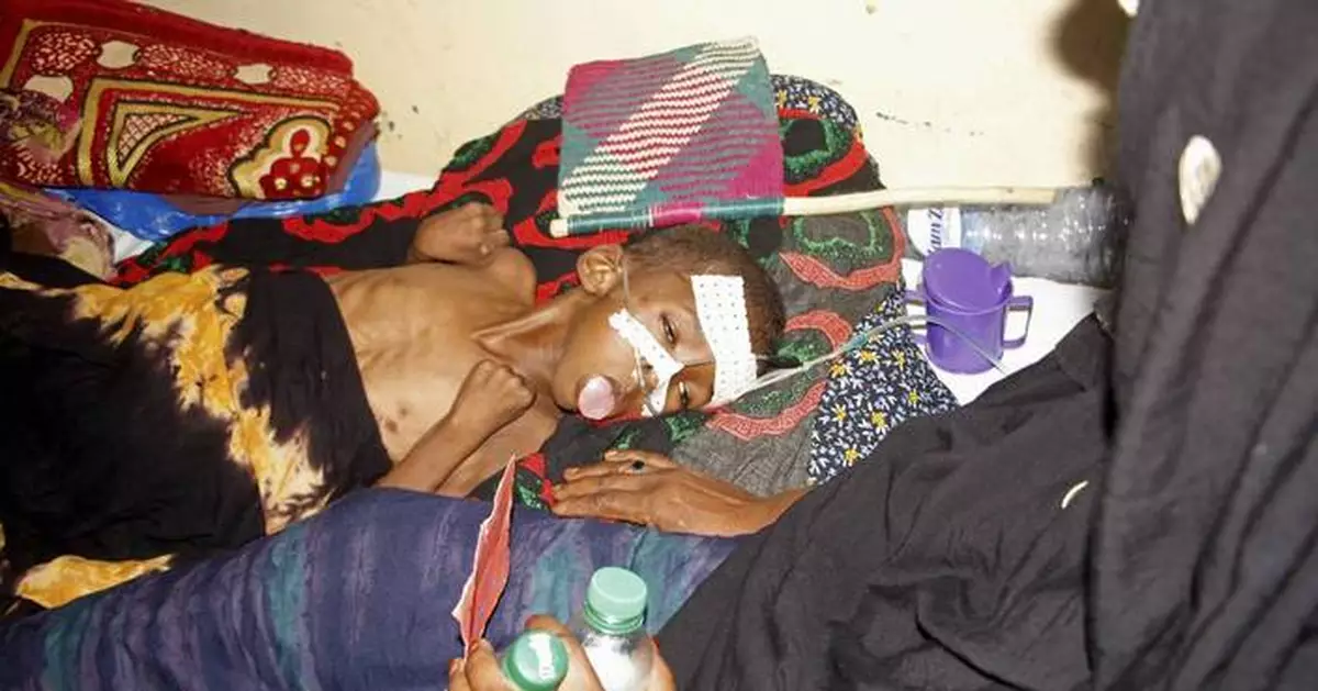 US aid kept many hungry Somali children alive. Now that money is disappearing