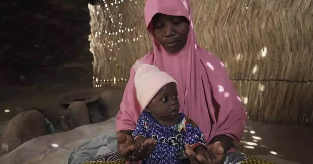 Children die as USAID aid cuts snap a lifeline for the world's most malnourished
