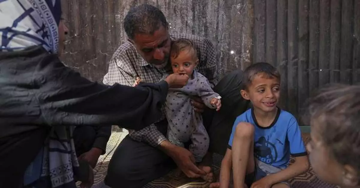 Takeaways from AP's reporting on child malnutrition in Gaza