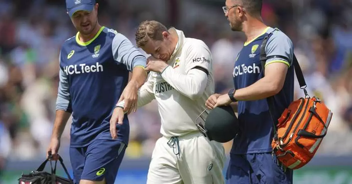 Australia batter Steve Smith out of WTC final after breaking pinkie