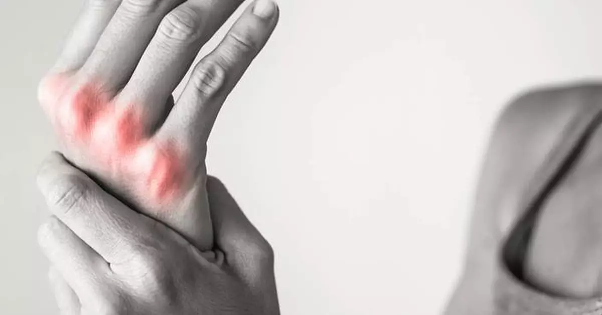 HSS Research at EULAR 2025 Congress Shows Routine Test Could Enable Faster, More-Effective Personalized Rheumatoid Arthritis Treatment