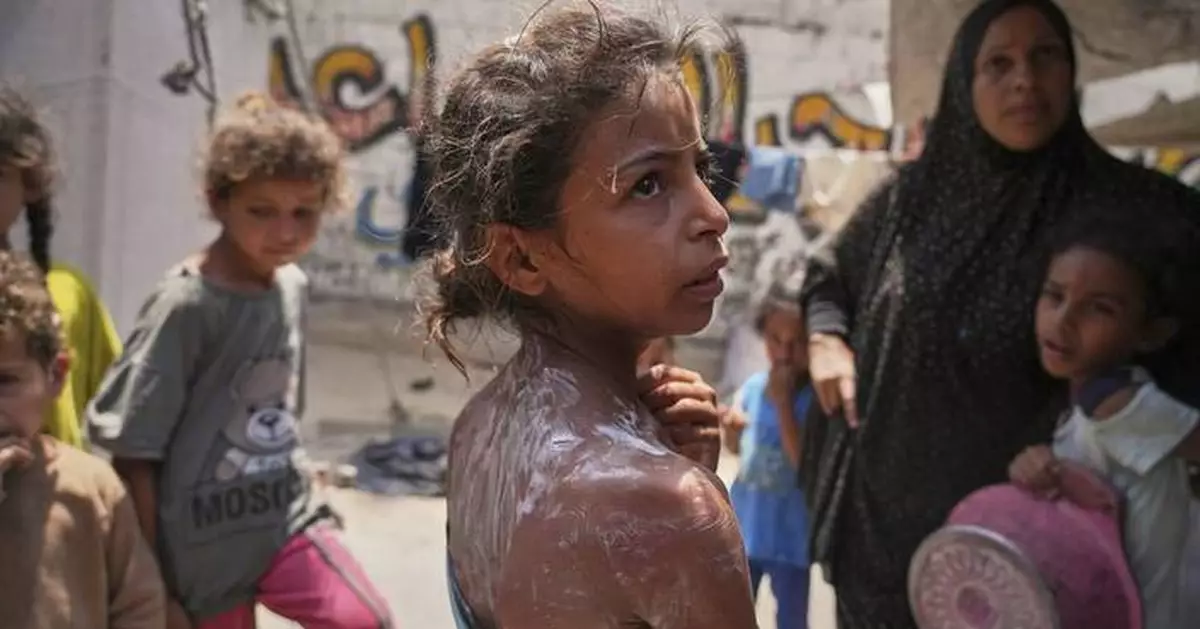 36 Palestinians killed trying to obtain desperately needed aid in Gaza, officials say