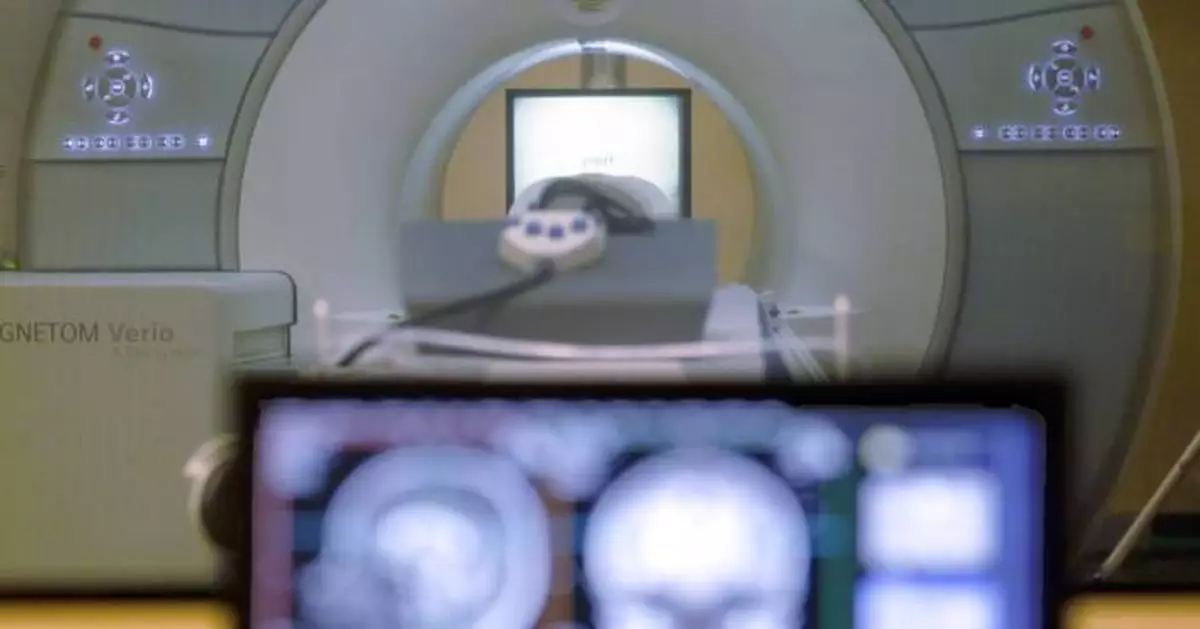 Man pulled into MRI machine after he walked into an exam room wearing a chain necklace