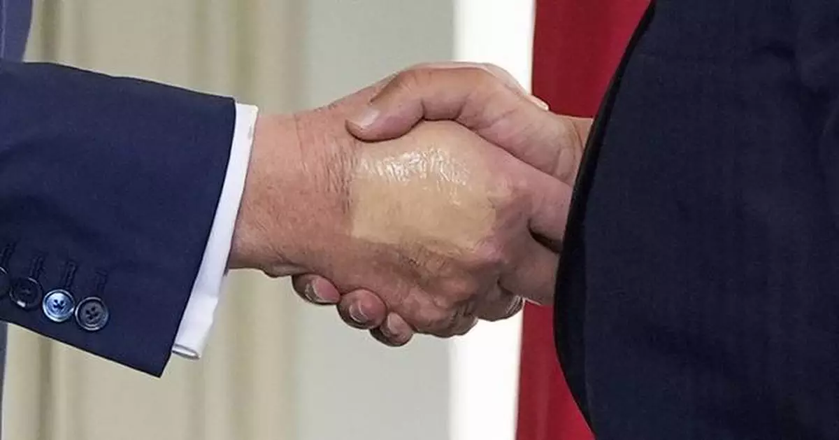 Trump is checked for lower leg swelling and diagnosed with a common condition in older adults