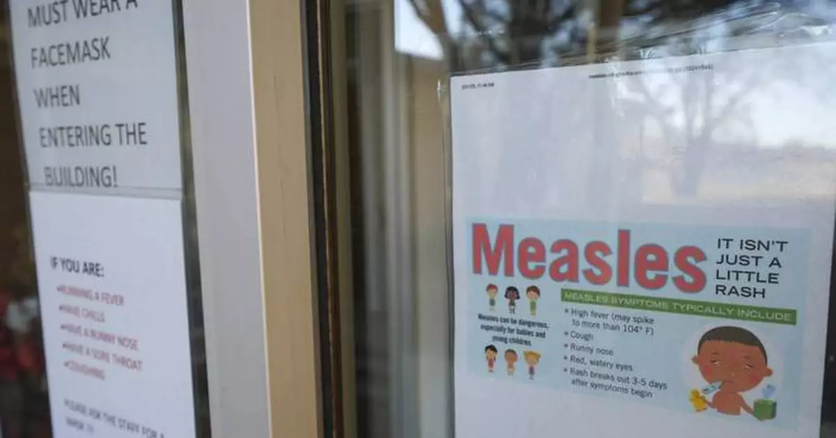 Colorado's measles outbreak is over, and the weekly US case count continues to diminish