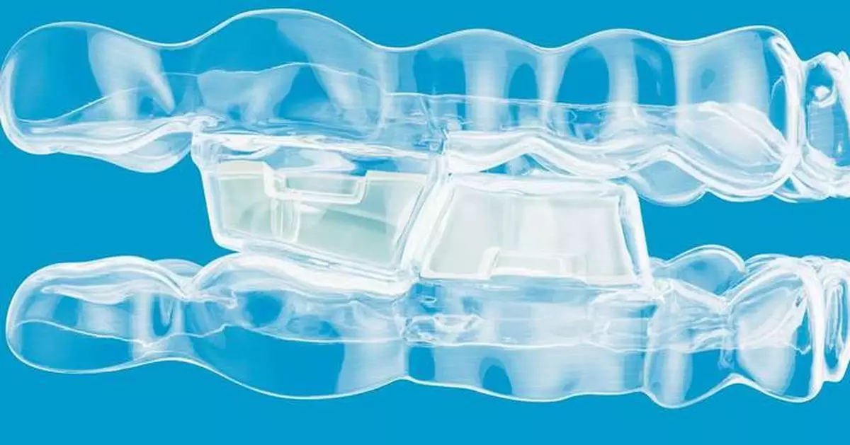 Align Technology Announces Invisalign® System With Mandibular Advancement Featuring Occlusal Blocks for Class II Skeletal and Dental Correction