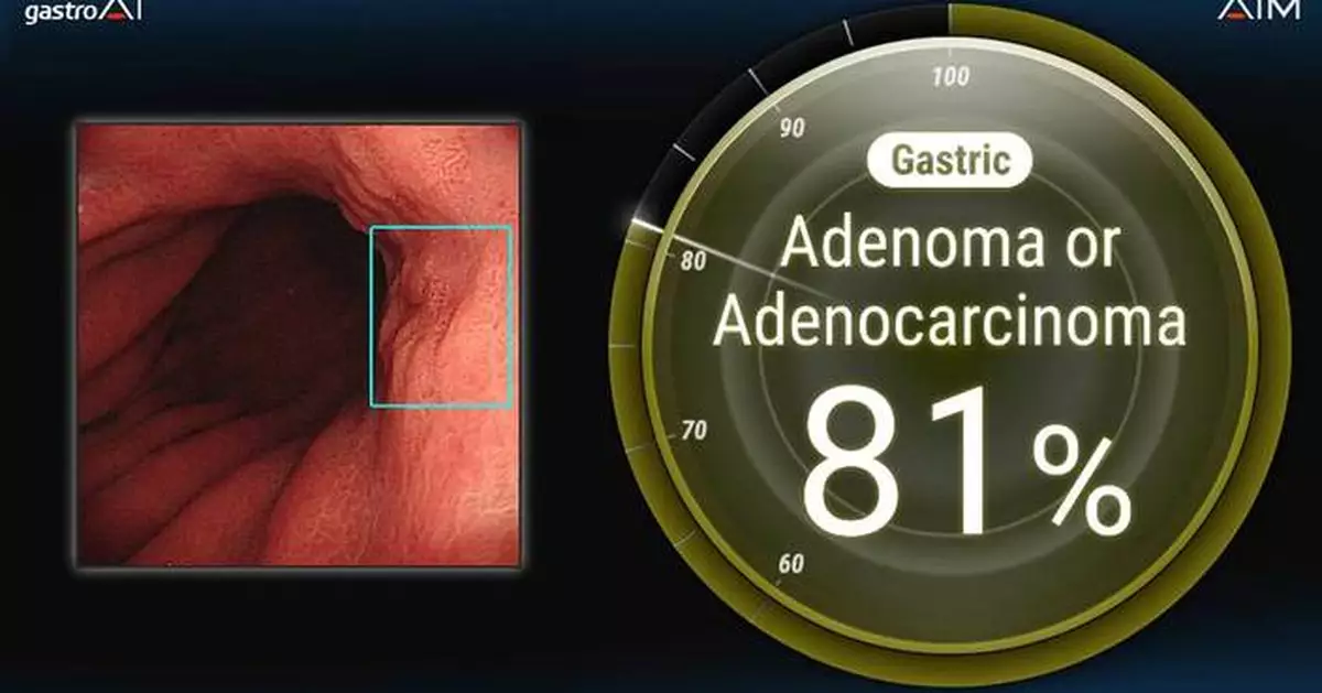 Endoscopic AI: AI Medical Service Inc. Has Obtained Regulatory Approval from Thailand’s FDA for Its Gastric AI-based Endoscopic Diagnosis Support System