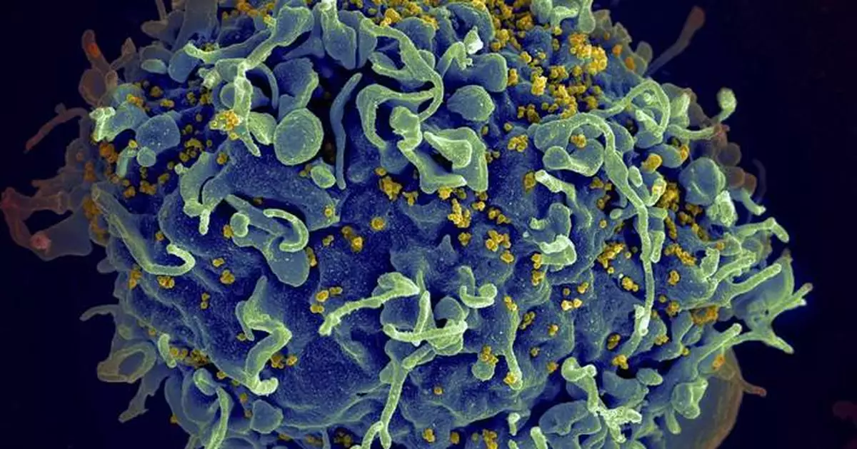 EU regulator green lights an injectable HIV drug that could help stop transmission