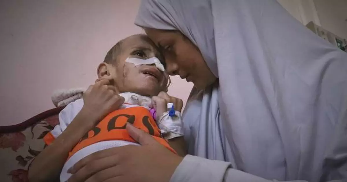 Photos of a Gaza toddler fighting for his life after an airstrike