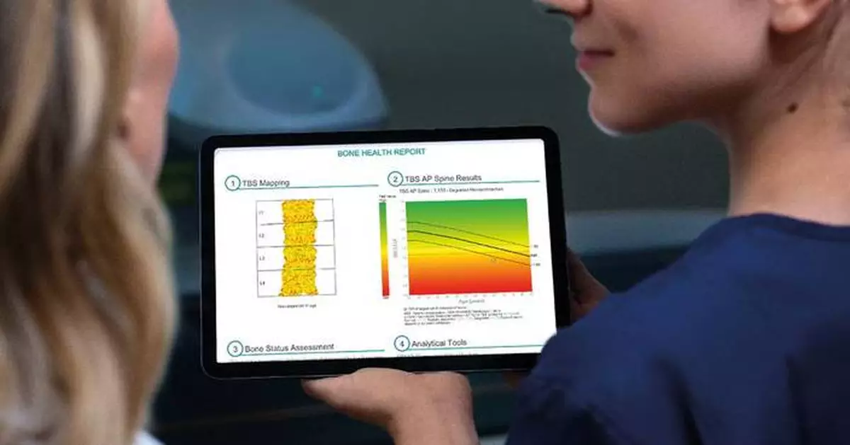 Medimaps Group Launches In Europe TBS Osteo Next-Generation Software For Advanced Bone Microarchitecture Assessment