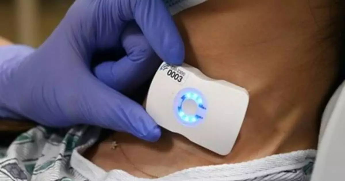 Sutter Health Hospitals Deploy Wearable Ultrasound Tech to Personalize Fluid Management for Sepsis