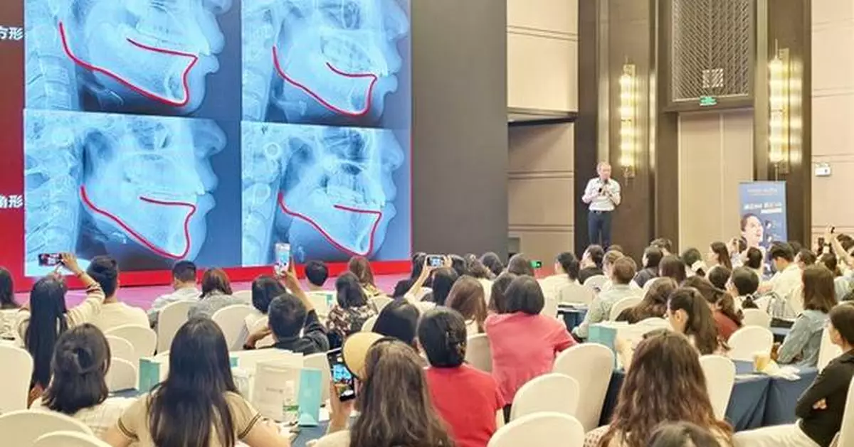 Australian Dentists Endorse Smartee's Mandibular Repositioning Technology at Global Symposium in Kunming