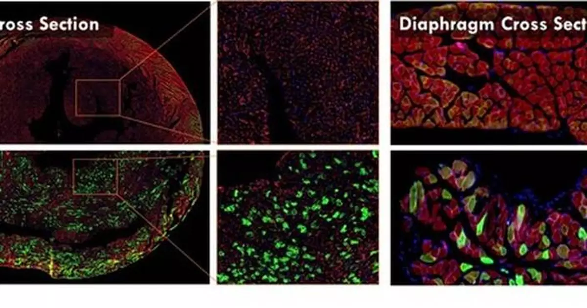 METiS Technologies Showcases AI-Powered Nanodelivery Platform at the 2025 Controlled Release Society Annual Meeting