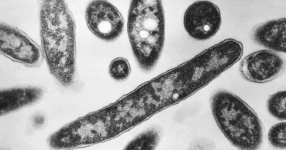 What to know about Legionnaires' disease, which has sickened dozens in New York City