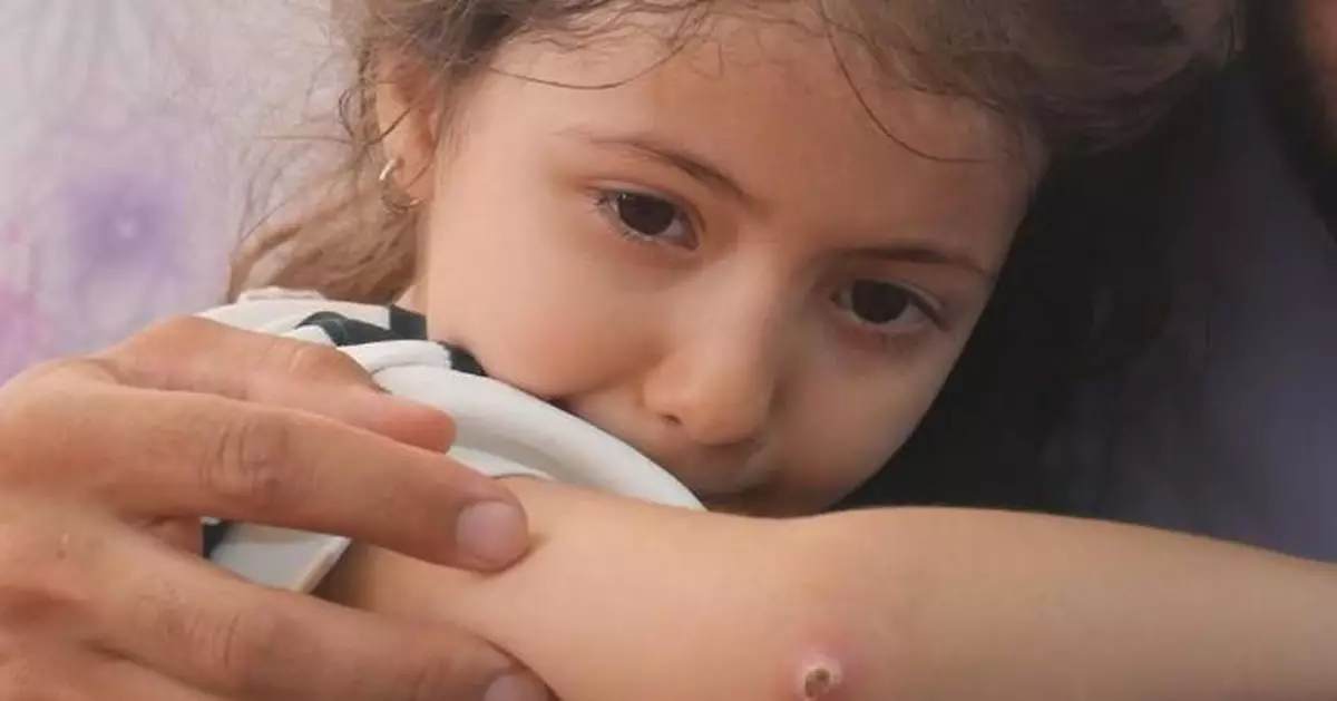 Afghan children scarred by Israel-Iran conflicts