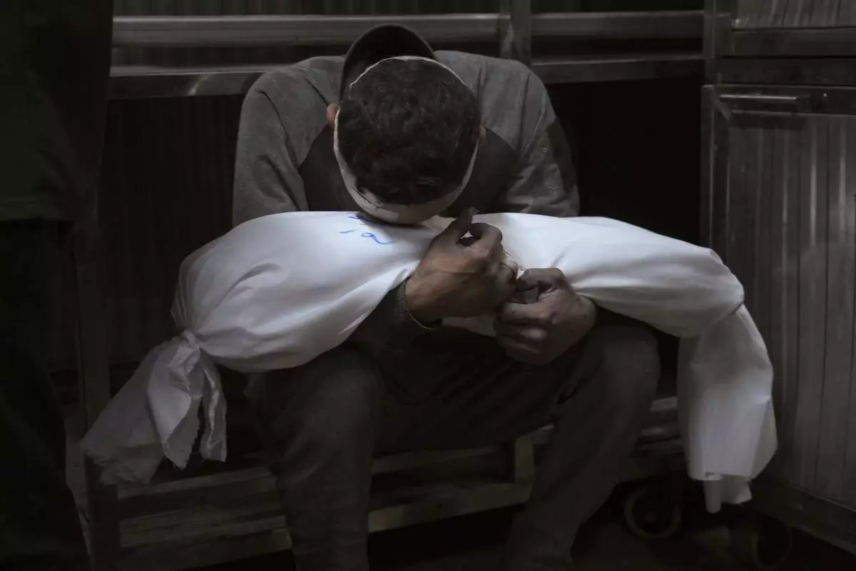 Hossam Azzam holds the body of his son Amir who was killed in an Israeli military airstrike on Gaza, at Shifa Hospital in Gaza City, July 15, 2025. (AP Photo/Jehad Alshrafi)