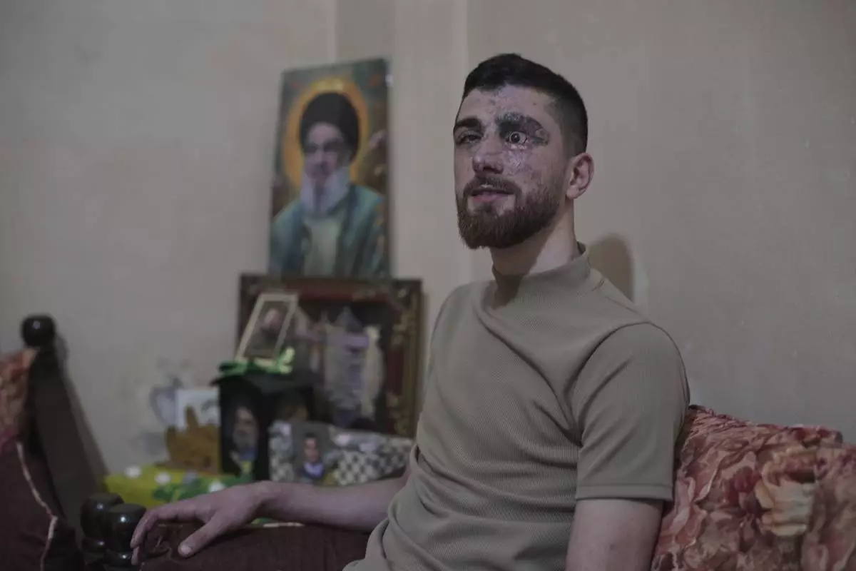 Mahdi Sheri, 23, who was wounded in the pagers attack carried out by Israel on September 17, 2024, speaks during an interview with The Associated Press in Beirut's southern suburb of Burj al-Barajneh, Lebanon, Monday, May 12, 2025. (AP Photo/Hassan Ammar)