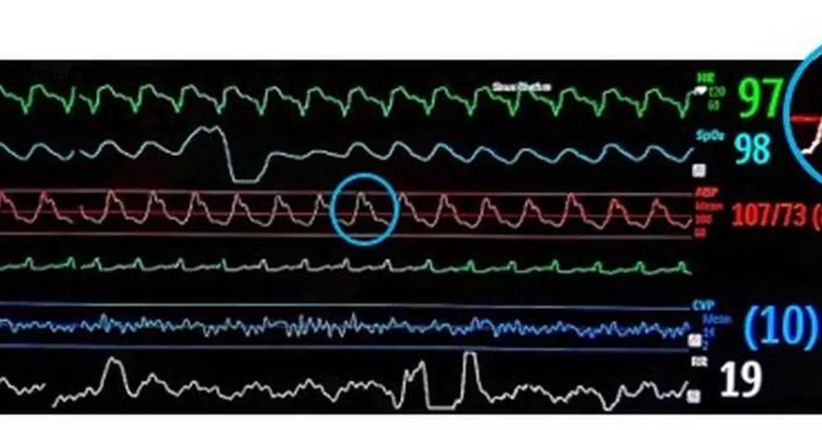 CorWave Announces Presentation of Late Breaking Results from its First-In-Human Implant at HFSA Annual Scientific Meeting