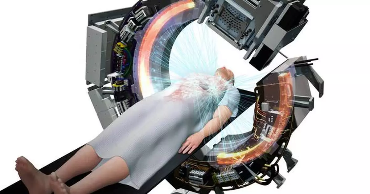 RefleXion Medical Announces First Clinical Outcomes for SCINTIX Therapy in Lung and Bone Tumors