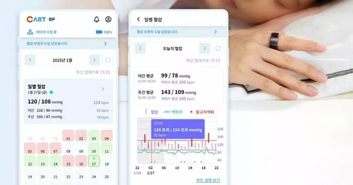 Sky Labs Launches CART BP, a Ring-Type Cuffless Blood Pressure Monitor