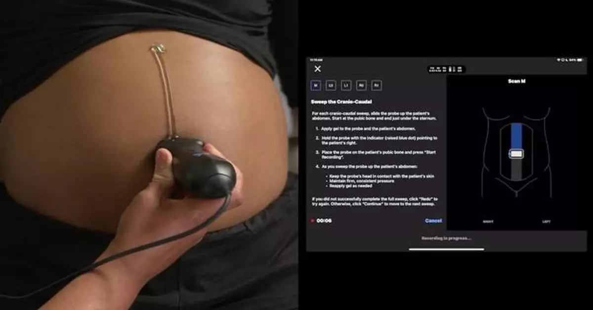 Butterfly Network Launches First-to-Market Artificial Intelligence Gestational Age Tool in Sub-Saharan Africa to Improve Maternal Health