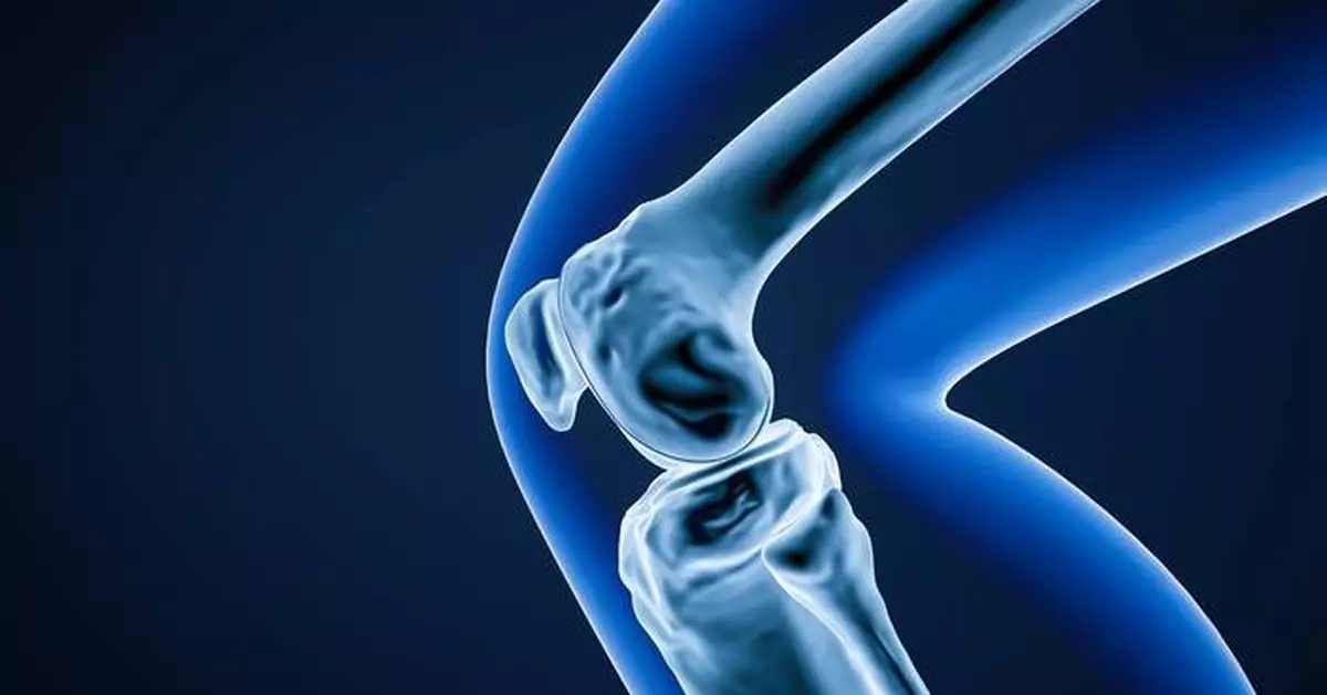 Significant Gift Funds Development of the HSS Digital Twin Platform for Optimizing Orthopedic Care