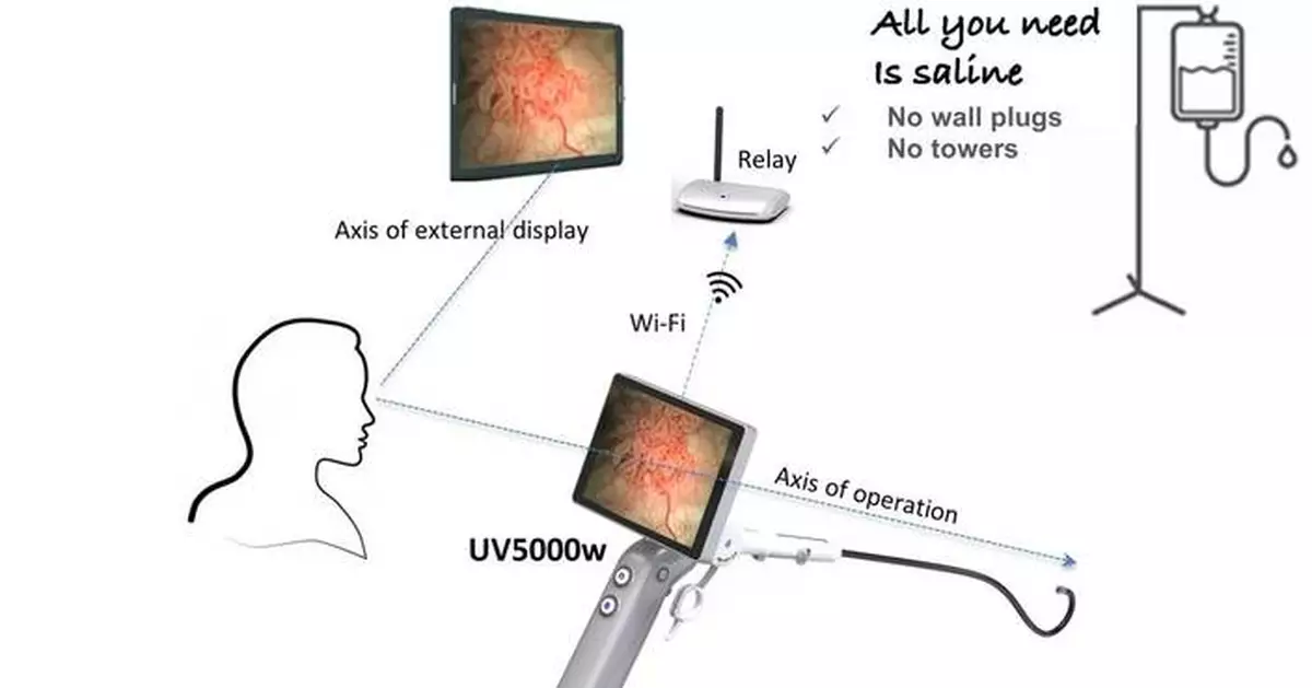 UroViu Receives CE Certification of Its Wi-Fi Enabled Cystoscope and Hysteroscope Product Portfolio