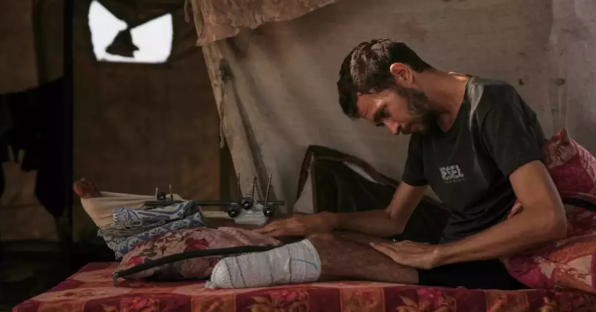 Photos of amputees in Gaza, struggling to survive after losing limbs to Israeli airstrikes