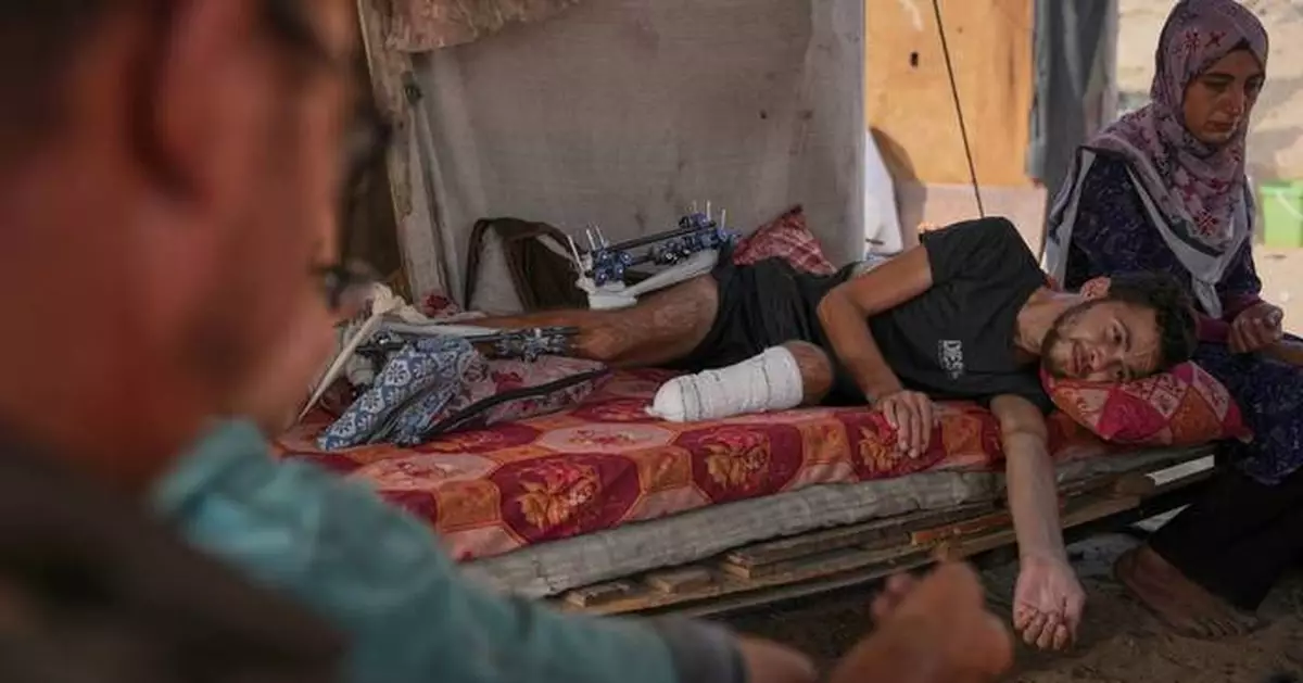Photos of amputees in Gaza, struggling to survive after 
losing limbs to Israeli airstrikes