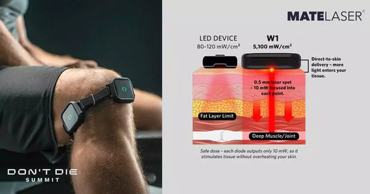MATELASER W1 REGEN: The Lightest 24g and Highest 5,100 mW/cm² Wearable Red Light Therapy Device Debuts on Kickstarter