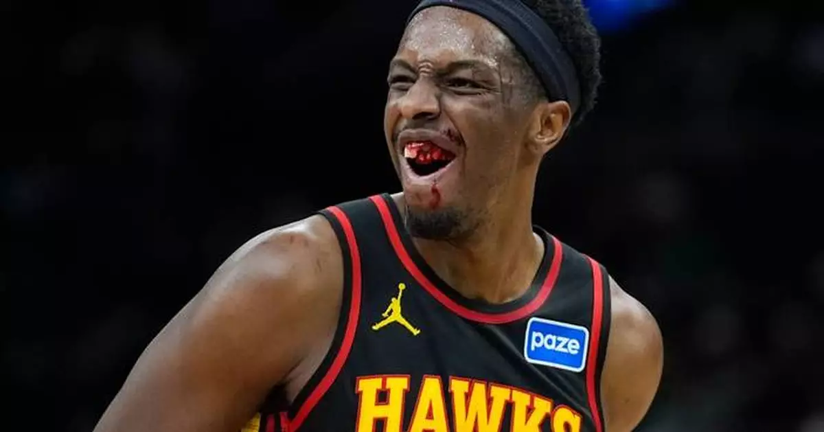 Onyeka Okongwu has a dental fracture after elbow to the face and will miss Hawks' game vs. Rockets